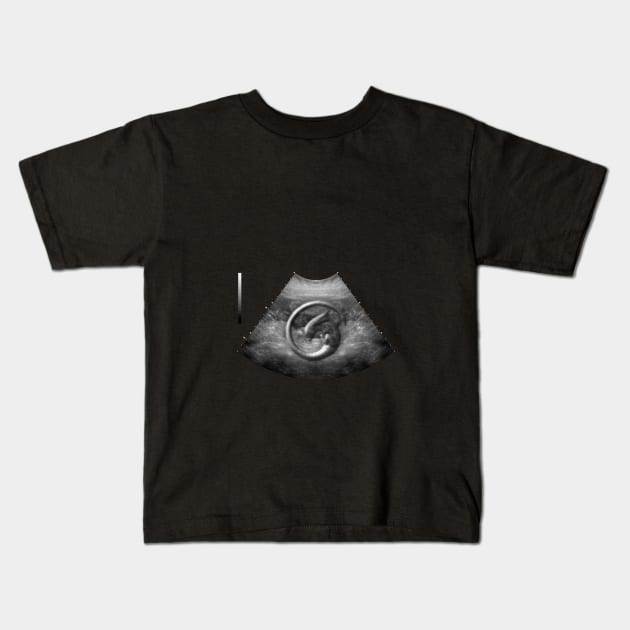 Alien on Board - Ultrasound Kids T-Shirt by adam@adamdorman.com